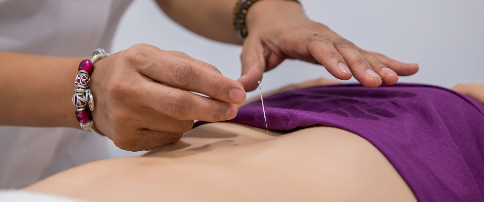 About Traditional Acupuncture